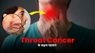 throat cancer symptoms & Risk Factors | throat cancer ke lakshan  #throatcancer #doctor  #healthcare