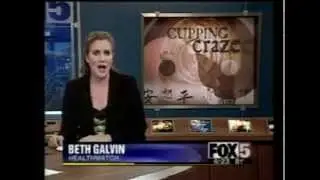 Metro Acupuncture: Cupping for Pain Relief on Atlanta's Fox 5