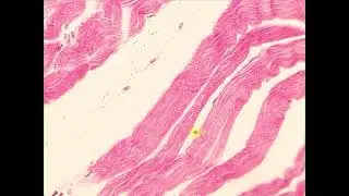 Skeletal muscle Skeletal muscle, muscle organ