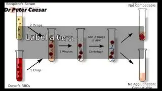 Blood Transfusion and types of cross matching(GXM).#majorcrossmatching #blooddonation