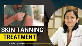 Skin tanning | Skin tan removal laser treatment | Skin tanning treatment | Skin tan&nbsp;removal&nbsp;|&nbsp;Satya