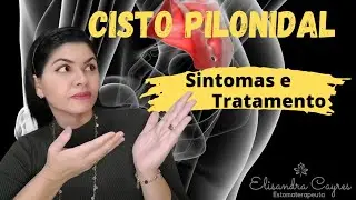 CISTO PILONIDAL - CONFIRA OS SINTOMAS E TRATAMENTOS - ESTOMATERAPIA