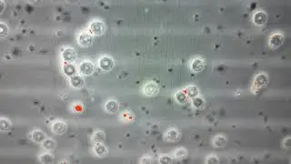 How Platelet Aggregates Reduce Apparent Platelet Counts in PRP