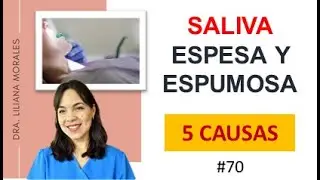 😱5 causas de SALIVA ESPESA, blanca y espumosa👉Episodio 70.