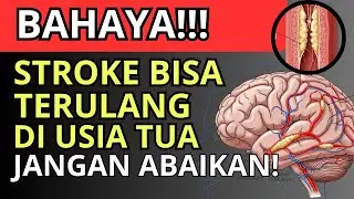 BAHAYA‼️STROKE Kedua Bisa Terjadi Diam-Diam, Lakukan ini Sebelum TERLAMBAT!