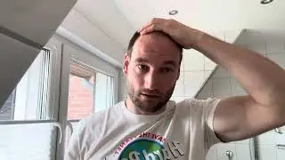 Dr. Balwi Hair Serum - Haartransplantation in der T&uuml;rkei mit Elithair