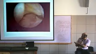 Ligaments Injuries in knee Dr. Akram Aldawody