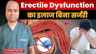Erectile Dysfunction का असली इलाज | Non-Surgical ED Treatment 2025 | Dr. Deepak Agarwal