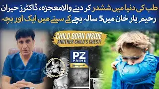 Rare Medical Case Shocks Doctors | Child Diagnosed with Fetus in Fetu in Rahim Yar Khan