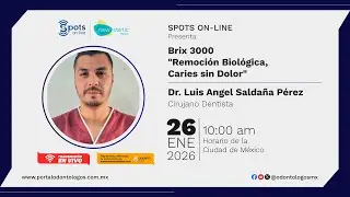 Spots On-Line: Brix 3000 