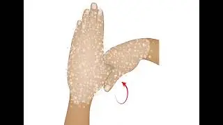 Podcast - GI Endoscopy Technology Primer - Infection Control - 1. Hand Hygiene