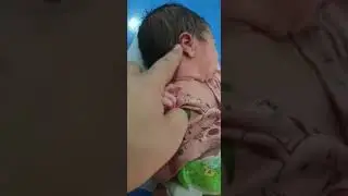 A case of cystic hygroma
