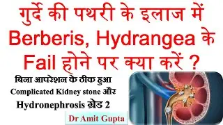 if #Berberis, #Hydrangea do not work, what to do in kidney stone-Cured case of complex KIDNEY STONE