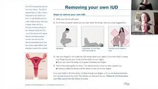 IUD Symposium Webinar:  Diana Greene Foster