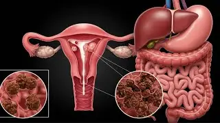 Your Gut's Hidden Secrets: A Deep Dive into Digestion & Stool Formation