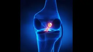 Dr Mook's ACL Rehab   SD 480p