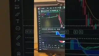 5 STOCKS TO WATCH NOW 📈 (JANUARY 22, 2025)