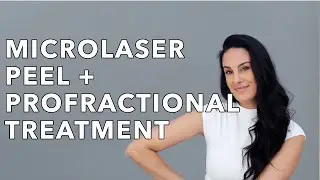 MicroLaser Peel & Profractional Laser for Skin Resurfacing | Nazarian Plastic Surgery