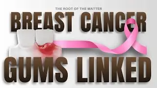Oral Health & Breast Cancer | How Gum Disease, Hormones, and Inflammation Are Connected