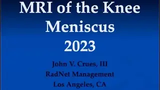 MRI of the Knee: Meniscus 2023, Part 4