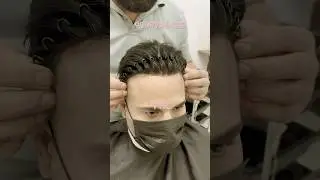 No 1 Hair Patch ￼ | 100% Natural Look | Hair Patches For Men #hairpatch #hairreplacement