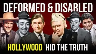 The Strangest Physical Deformities Of Hollywood Stars