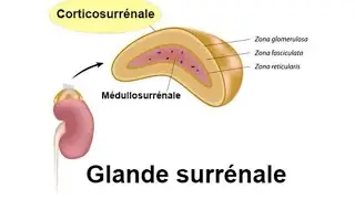 📍Comprendre Un cas clinique sur 