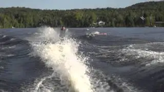 My Waterski Crash or How to Break your Fibula