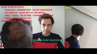 hair maintenance + common hairstyles : Hair Transplant 2nd🔴6 months update #FUE #hairtransplant