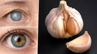 Я Была Слепой, но Теперь Я Вижу &mdash;🧄19 Рецептов с Чесноком