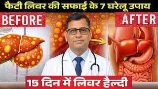 7 Powerful Home Remedies For Fatty Liver | फैटी लिवर का जड़ से इलाज | Natural Fatty Liver Treatment