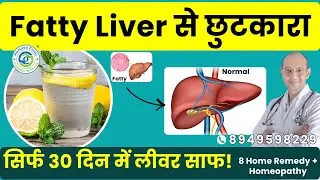 Fatty Liver Ka Ilaj 🛑 8 चीज़ें जो लीवर को ठीक कर देंगी! | Fatty Liver Home Cure & Homeopathy