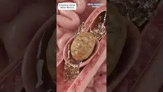 Intestine Animation of Moist Stool Mass Propelled Forward by Peristalsis  #motivation #shorts