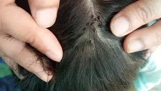 Nitpicking ASMR mother removed son 😅 clean hair 