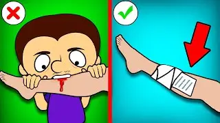 How to survive a poisonous snake bite