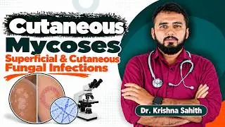 6. Кожные микозы | Поверхностные и кожные грибковые инфекции | USMLE Step 1 🧬
