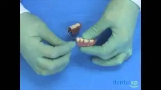 Adjusting RPD Clasps