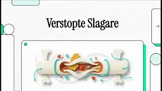 113 Verstopte Slagare