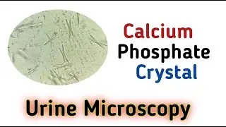 calcium phosphate crystal I Tanu Path