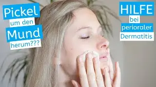 [4K] Was tun bei Pickeln um den Mund herum? Das hilft bei perioraler Dermatitis