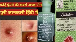 Antiboctrin oil#sideeffect #full review in hindi#queenpriya