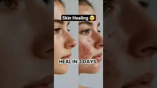 How to Heal Your Skin Naturally ✨️ #shorts #cleanbeauty #skincare #skinbarrier #skinhealing