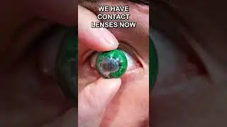 The Future of Augmented and Virtual Reality: A Contact Lens Experience #shorts