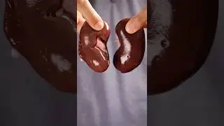 Как сделать почки