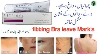 Retrive Cream | Freckles , Darkspots Removal Cream | Side effects , uses , benefits in Urdu , Hindi