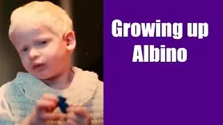 Growing up Albino/childhood struggles with Albinism/tips for legally blind at school/Albino student
