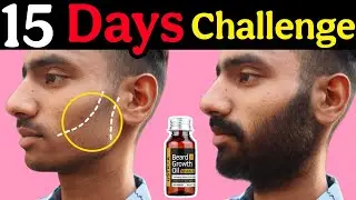 Ustraa Advanced Beard Growth Oil After 15 Days Review |Best Beard Oil For Patchy Beard in India 2025