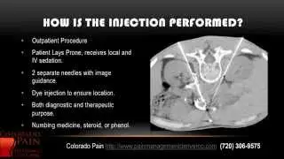 Celiac Plexus Block at a Denver Pain Management Clinic