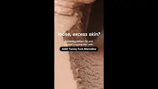 AbEX Tummy Tuck Alternative
