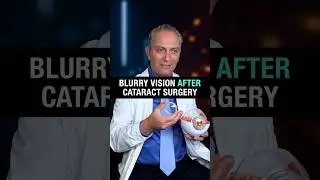 Why Is My Vision Still Blurry After Cataract Surgery?